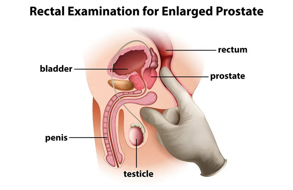 Enhance Your Wellness with Prostate Massage: Unveiling the Benefits